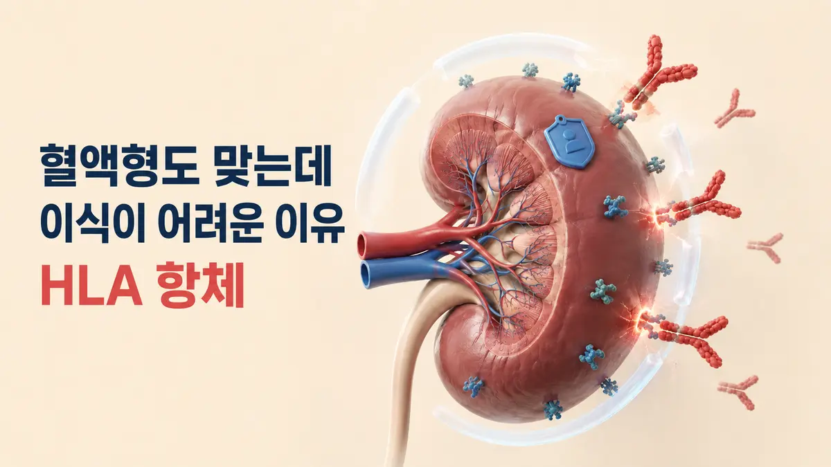 혈액형도 맞고 HLA도 괜찮은데 이식을 못 할 수도 있다?: HLA 항체란 무엇일까